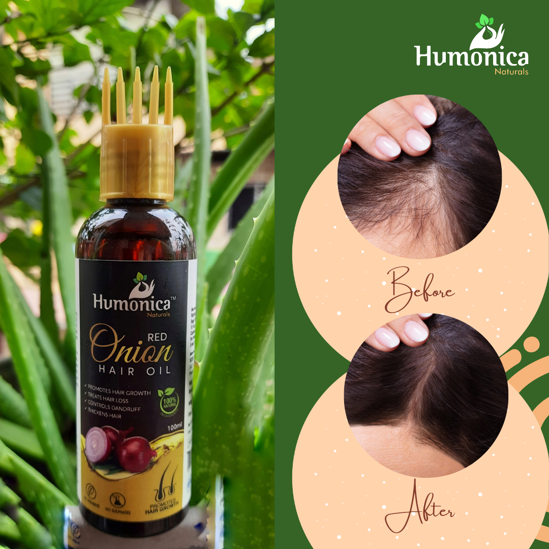 Humonica Naturals Red Onion Hair Oil for Hair Fall, Regrowth & Thickness